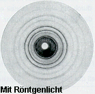 Interferenzmuster von Rntgenbeugung an Silberfolie